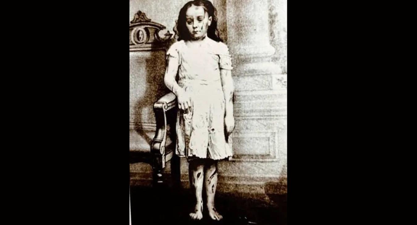 Honnan indult a gyermekvédelem?