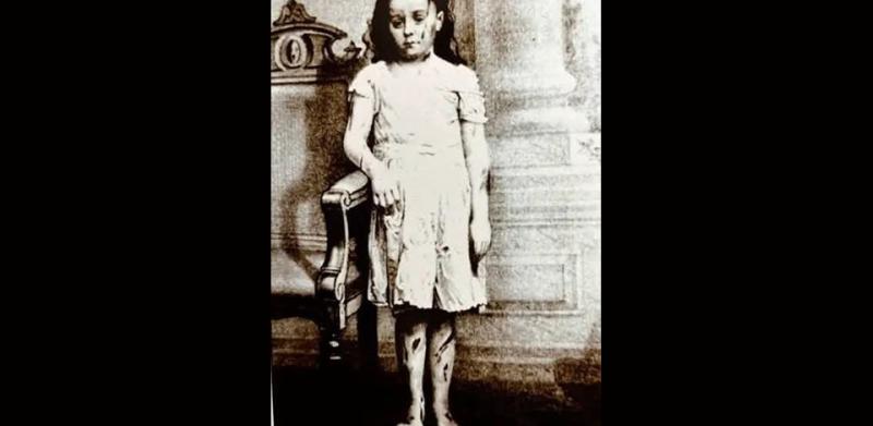 Honnan indult a gyermekvédelem?